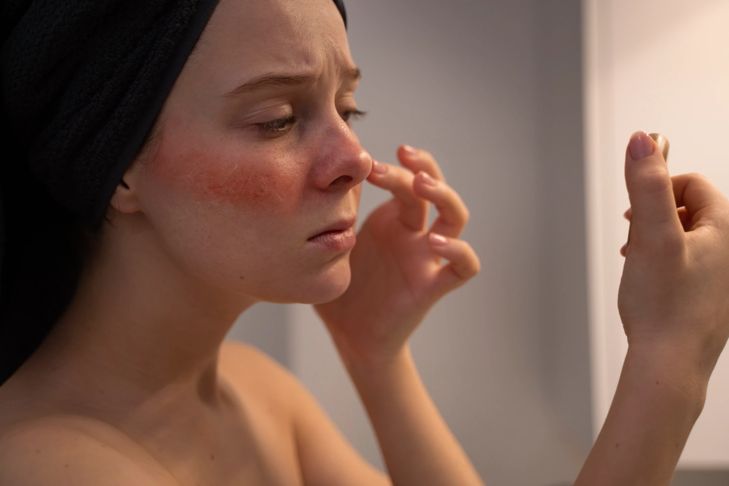 Rosacea behandling